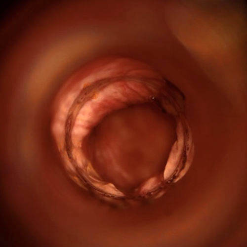 Proctologist Vascular Surgeon in Dubai