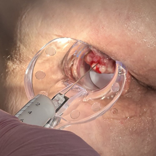 Proctologist Vascular Surgeon in Dubai
