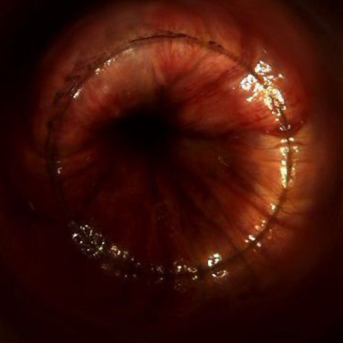 Proctologist Vascular Surgeon in Dubai